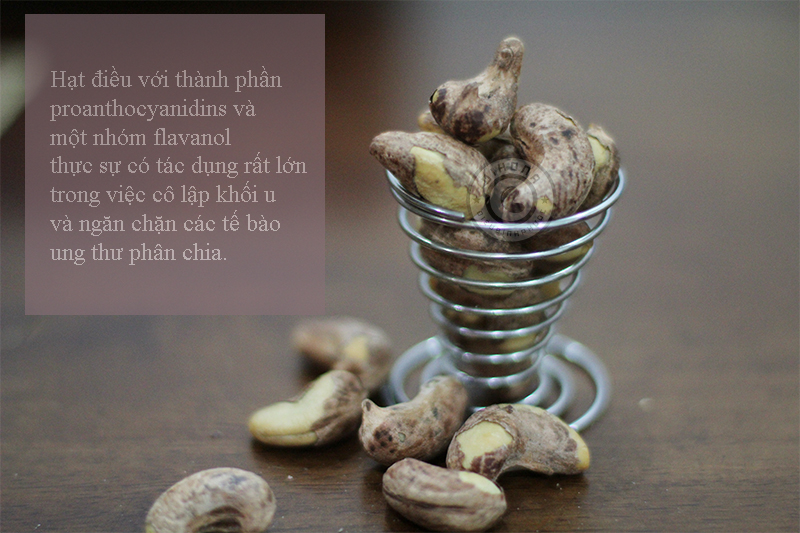 Hạt điều